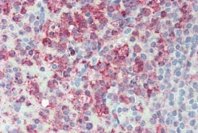 Immunohistochemistry-Paraffin: ERMP1 Antibody [NBP3-14315] - Immunohistochemistry of formalin-fixed, paraffin-embedded human spleen after heat-induced antigen retrieval.